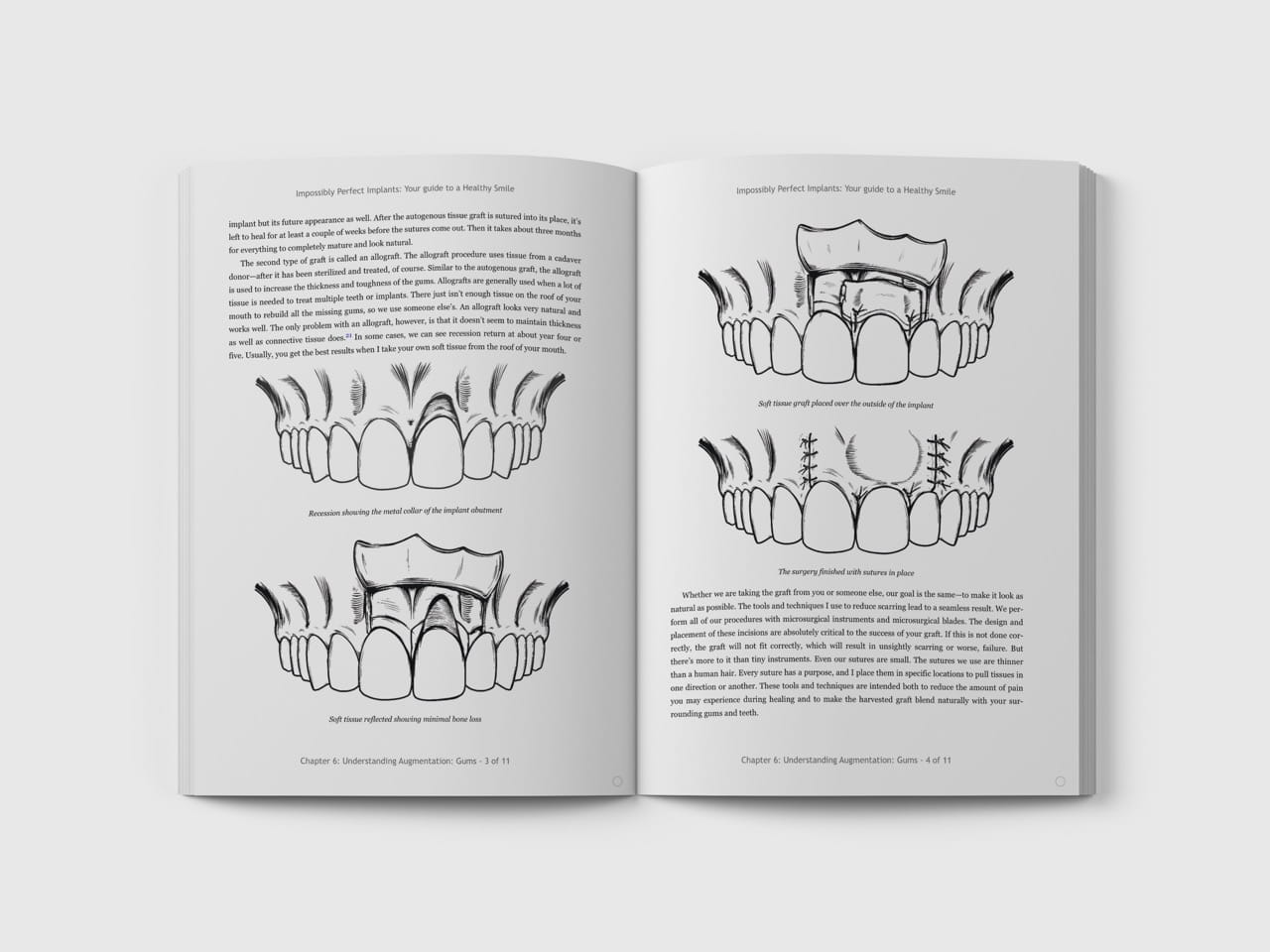 Dental Surgery